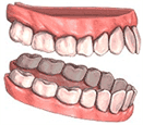 Prtesis dental